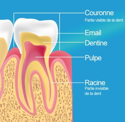 Dentiste Roubaix, dévitalisation